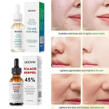 Saashi Facial Exfoliator Peeling Serum