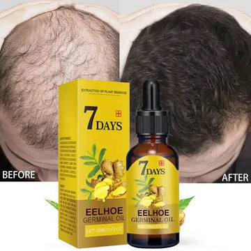 Saashi Ginger Hair Growth Serum