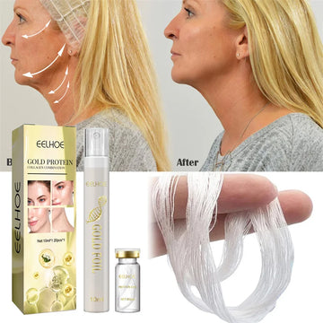 Saashi Protein Thread Lifting Kit for Face Lift